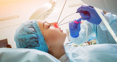 عمليات تجميل الأنف بدون جراحة.jpg